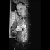 thumbnail Trompette